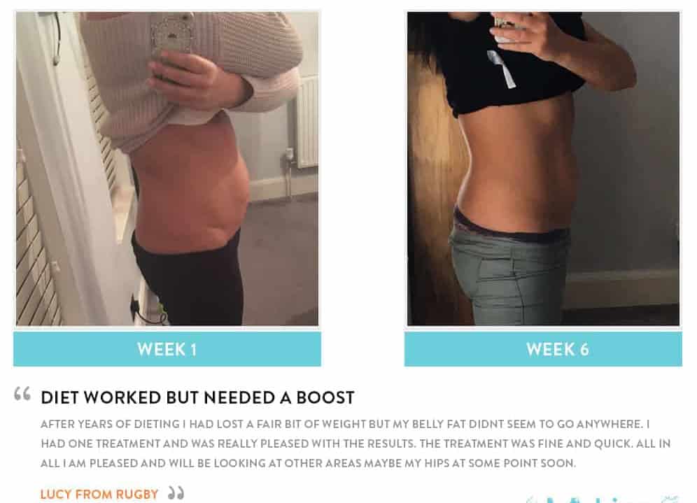 Before and After Dieting Ealing
