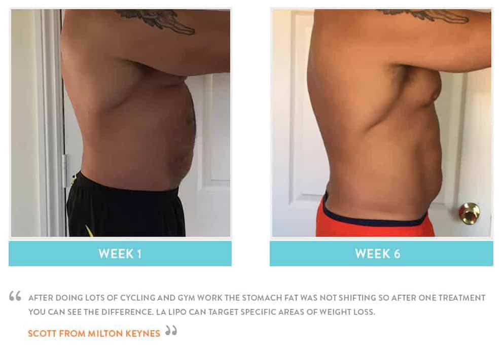 Before & After Stomach Fat Ealing