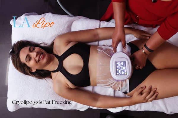 woman getting cryolipolysis Ealing