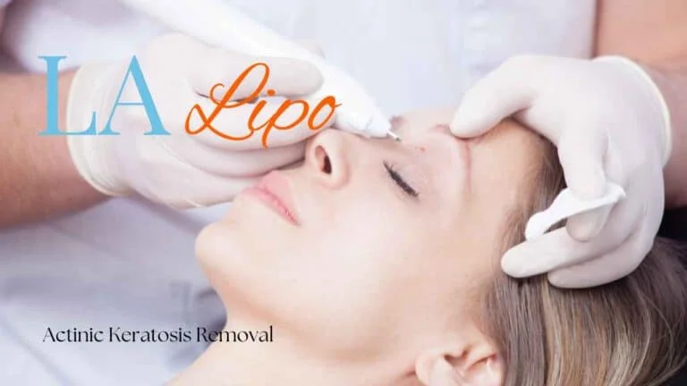 Woman receiving Actinic Keratosis Removal Treatment Ealing
