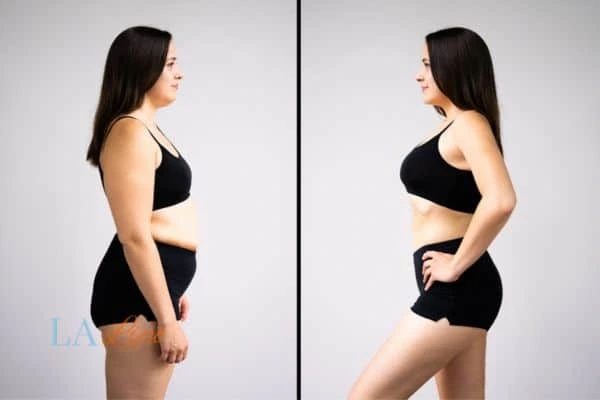 LA-EMS Body Sculpting Ealing results before and after of womans results on body toning.