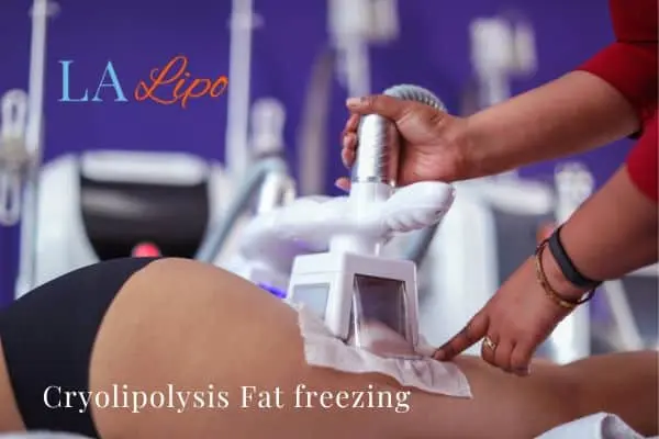 women getting fat freezing Ealing