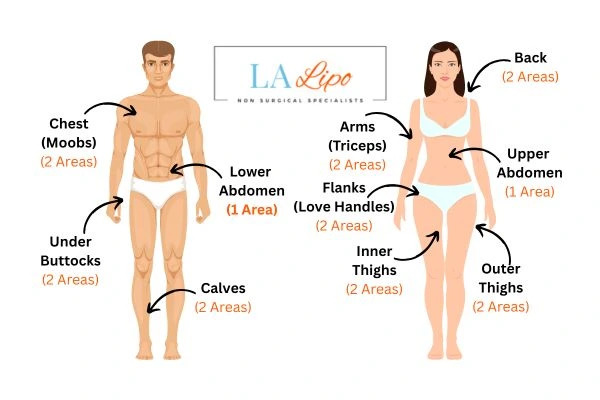 LA LIPO Cryolipolysis Areas Ealing