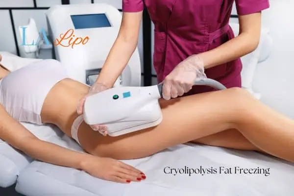 Woman receiving coolsculpting Ealing treatment on her thighs