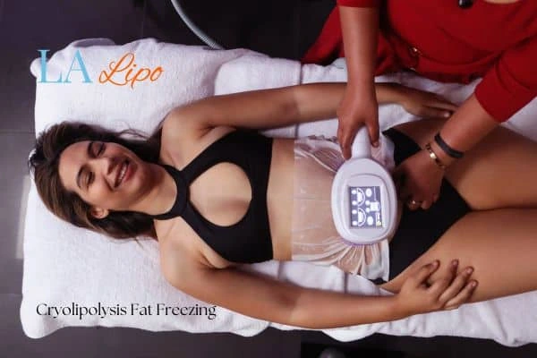 woman getting cryolipolysis Ealing