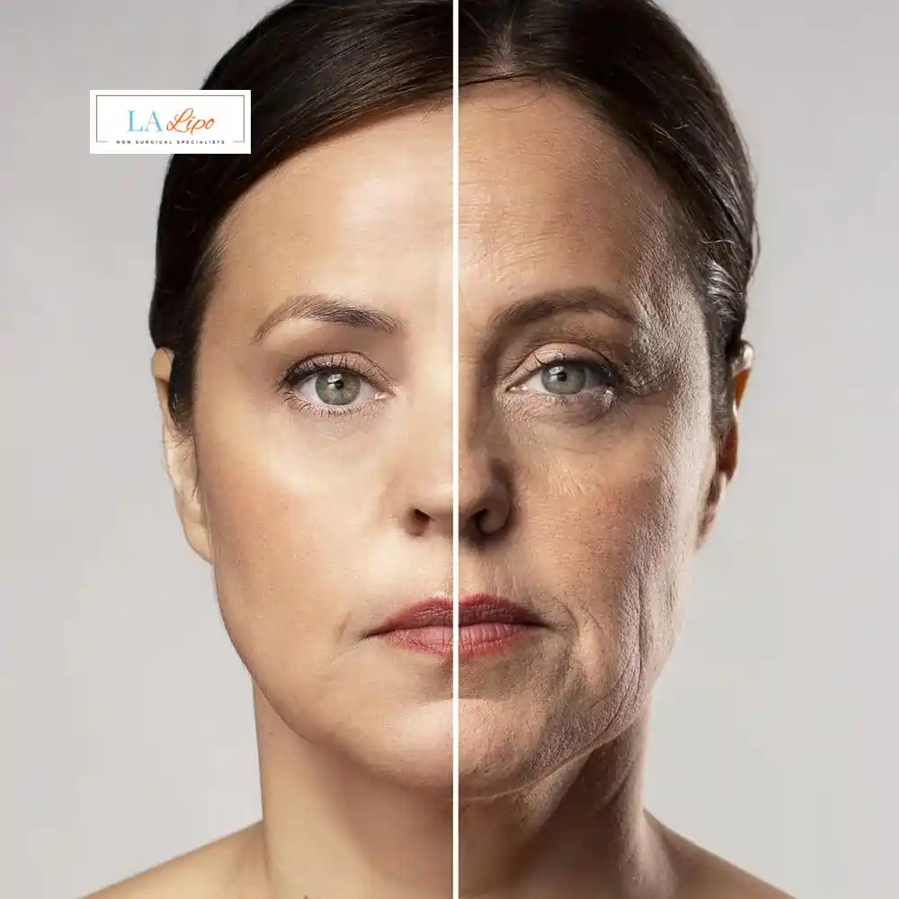 How Can You Tell If Non-Surgical Skin Tightening Is Right for You Ealing?