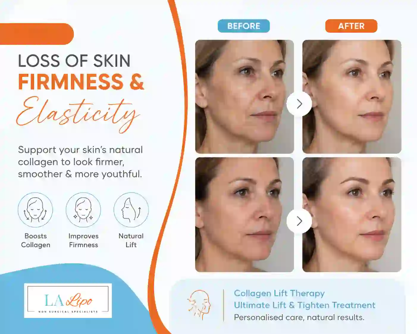 Sign #7: Loss of Skin Firmness and Elasticity Ealing